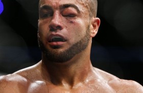 UFC 188: Eddie Alvarez and the Swollen Eye