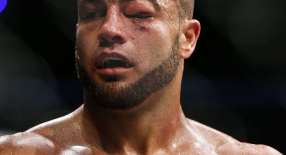 UFC 188: Eddie Alvarez and the Swollen Eye