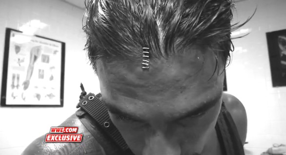 10 Worst Injuries in Professional Wrestling