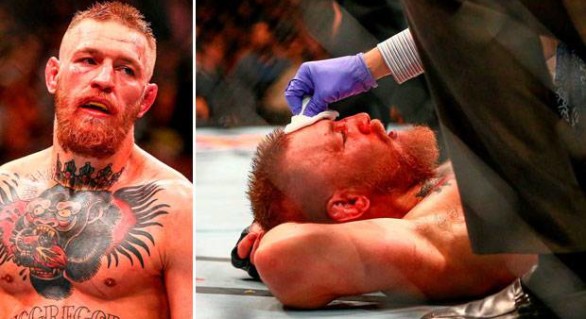 The Matchmaking Problem with Conor McGregor